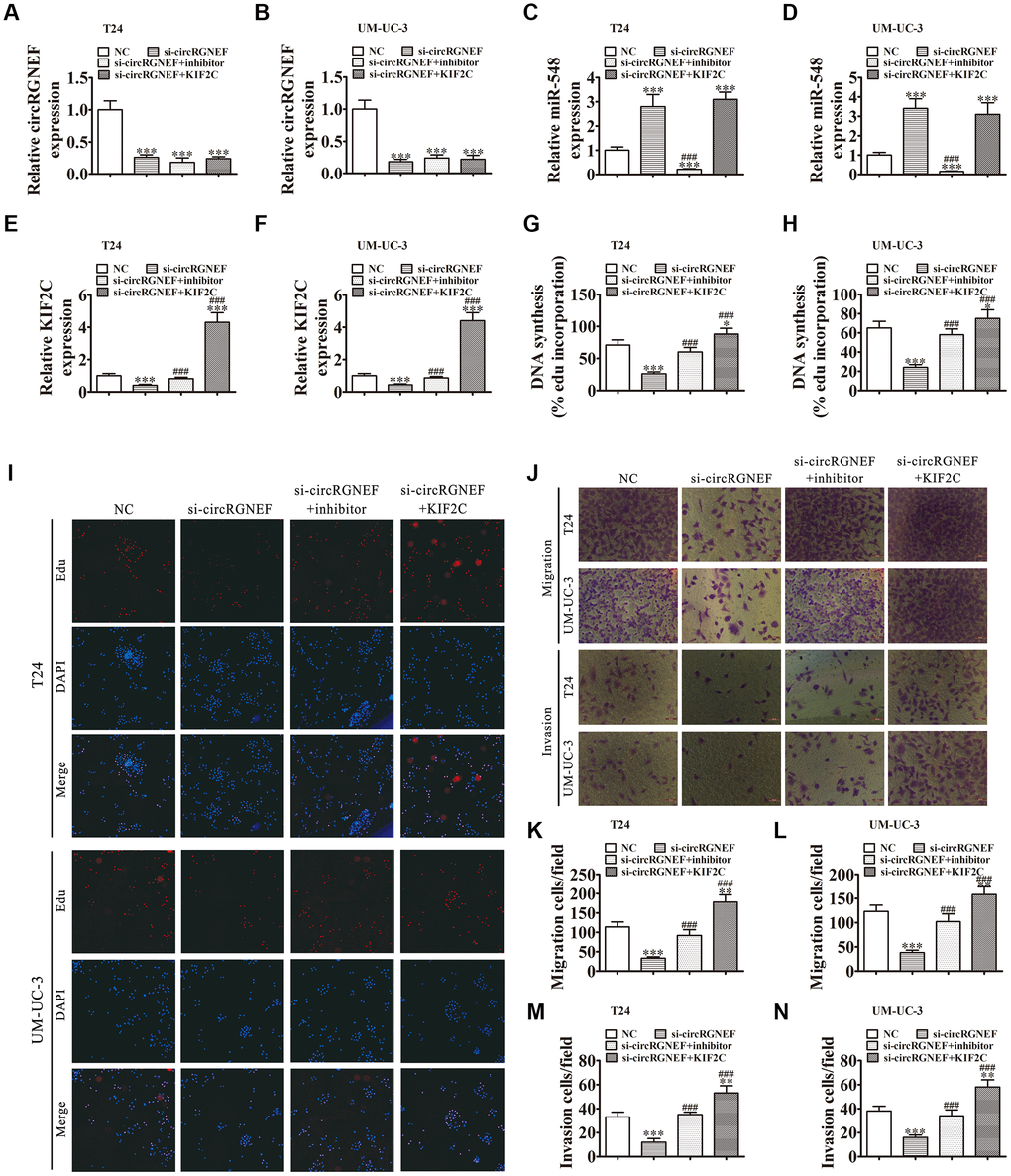 Downregulation of miR-548 or overexpression of KIF2C restored proliferation, migration, and invasion after circRGNEF silencing. (A–F) RT-qPCR shows the expression of circRGNEF (A, B), miR-548 (C, D), and KIF2C (E, F) in T24 and UM-UC-3 cells following transfection or treatment with NC, si-circRGNEF, miR-548 inhibitor, KIF2C overexpression vector (KIF2C) single or combined. Data are presented as the mean ± SD. ***P ###P G–I) Cell proliferation was analyzed by EdU assays. Data are presented as the mean ± SD. ***P ###P J–N) Cell migration and invasion were assessed in T24 and UM-UC-3 cells using Transwell assays. Data are presented as the mean ± SD. ***P ###P 