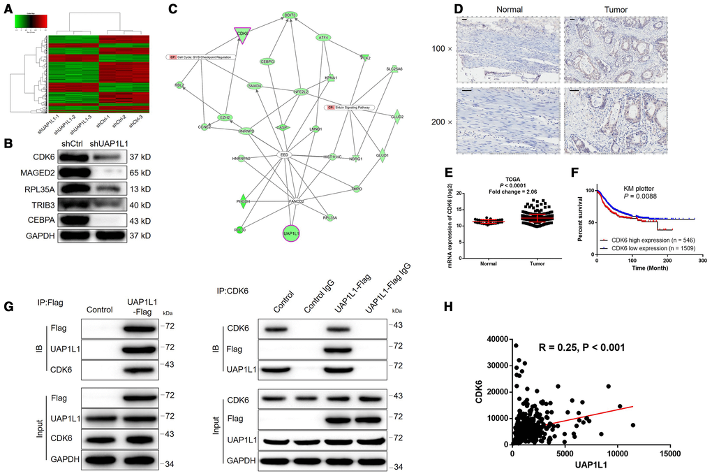 The exploration and verification of downstream underlying UAP1L1 induced regulation of gastric cancer. (A) A PrimeView Human Gene Expression Array was performed to identify the differentially expressed genes (DEGs) between shUAP1L1 and shCtrl groups of SGC-7901 cells. (B) Western blotting was used to detect the expression of several selected DEGs in SGC-7901 cells with or without UAP1L1. (C) A UAP1L1 associated interaction network constructed by IPA analysis revealed the potential linkage between UAP1L1 and CDK6. (D) The expression of CDK6 in gastric cancer tissues and normal tissues was evaluated by IHC analysis (scale bar = 50 μm). (E) Data mining of expression profiling in TCGA database showed the upregulated expression of CDK6 in gastric cancer tissues compared with normal tissues. (F) Data mining of prognosis in KM plotter database showed that patients with higher expression of CDK6 suffered from shorter survival period. (G) The direct interaction between UAP1L1 and CDK6 was demonstrated by co-immunoprecipitation. (H) Data mining of expression profiling in TCGA database revealed the positive correlation between UAP1L1 and CDK6 in gastric cancer tissues. The representative images were selected from at least 3 independent experiments. Data was shown as mean ± SD. *P P P 