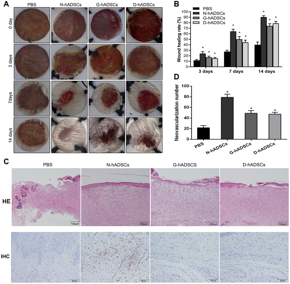 Glucolipotoxicity significantly reduced the treatment ability of hADSCs on skin wound healing in vivo. (A) Representative images of wound healing at time points; (B) Histogram of statistical analysis of healing rate of wounds at different time points; (C) Histology of inflammatory cell infiltration from dermis to subcutaneous layers was detected by HE staining (Scale bar = 100 μm); The content of CD31 in wound tissue was assessed by immunohistochemistry (Scale bar = 50 μm); (D) Quantification of CD31 in wound skin of different groups (* P