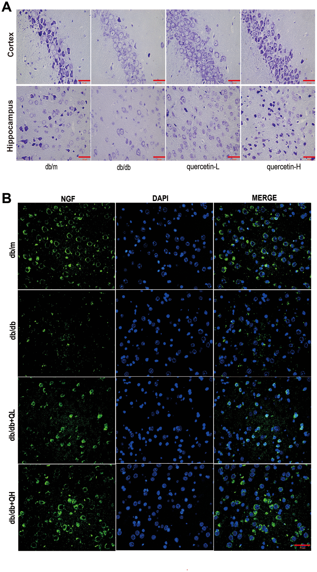 Quercetin ameliorates neurodegeneration in db/db mice. (A) Nissl’s staining. (B) Immunofluorescence of NGF. Scale bar: 100 μm.