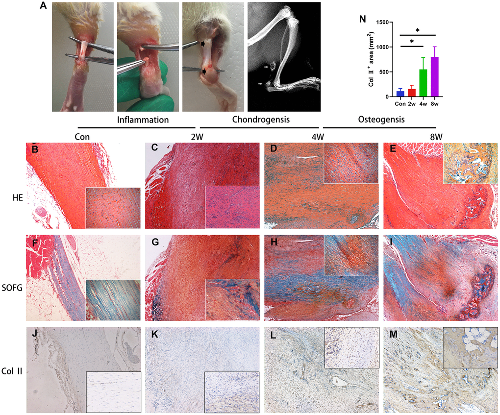 Endochondral ossification is the pathological basis of the heterotopic ossification model in the rat after tendon injury. (A) The HO model was made by complete transverse incision at the midpoint of Achilles tendon without any attempt of repair. Bone-like tissues formed near the position of the tendon-to-bone junction and tendon-to-muscle junction (arrow) at 8 weeks post-surgery. (B–I) The H&E and Safranin O/fast green staining. Inflammation infiltration was obvious at 2w, lots of chondrocytes could be found at 4w, and bone tissues formed at 8w. (J–N) The immunohistological staining of Col II + cells (brown). *p 