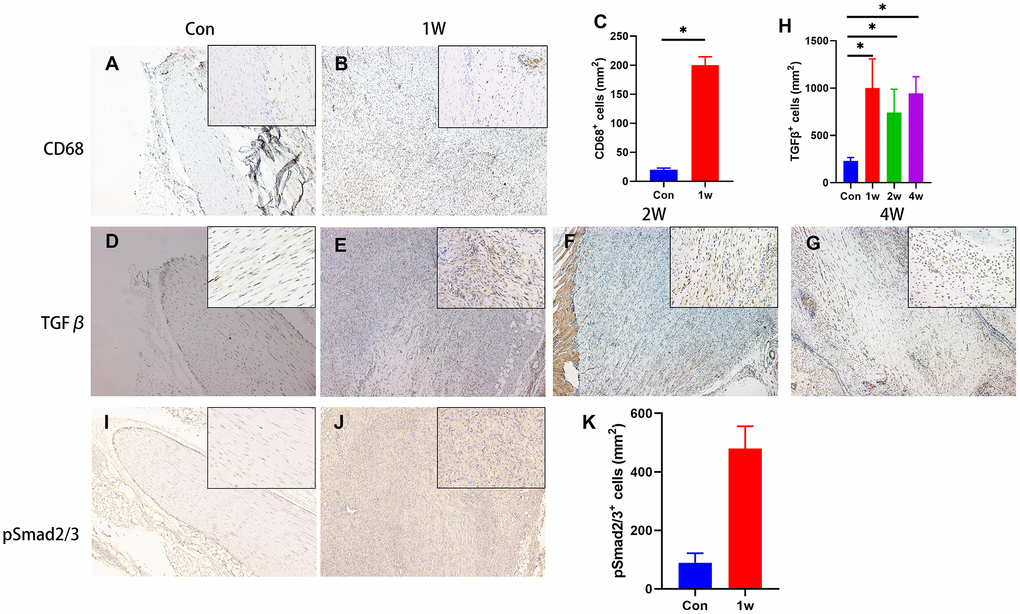 TGF-β signaling is elevated during the chondrogenic differentiation stage during HO development. (A–C) The immunohistological staining of CD68+ cells (brown). (D–H) The immunohistological staining of TGF-β1+ cells (brown). (I–K) The immunohistological staining of phosphorylated Smad2/3+ cells (brown). *p 