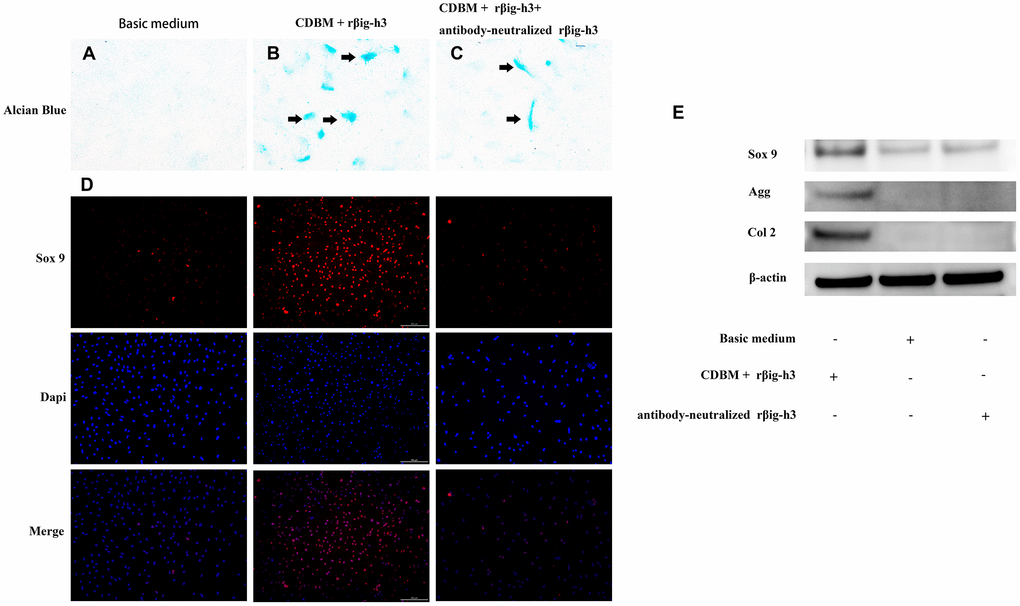 βig-h3 promotes the process of mesenchymal condensation and chondrogenic differentiation of cultured iTDSCs. (A–C) The mesenchymal condensation (black arrow) were detectable by day 14 with the additional rβig-h3, and the effect could be inhibited by the additional antibody-neutralized rβig-h3. (D) The immunofluorescence staining of Sox 9 showed more sox 9 expression by the additional rβig-h3. (E) The expression patterns of chondrogenesis genes Sox 9, Agg, and Col 2 in iTDSCs cultured with Chondrogenic Differentiation Basal Medium (CDBM), CDBM with additional rβig-h3, and CDBM supplied with additional rβig-h3 and antibody-neutralized rβig-h3. by western blotting.