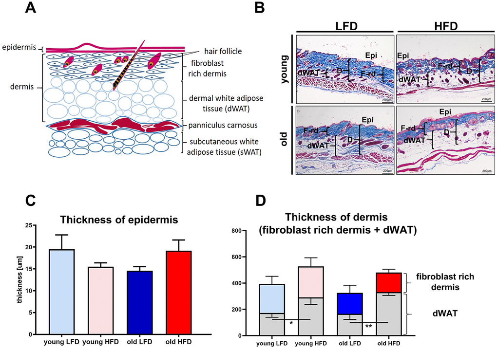 Histological analysis of skin structure and thickness. Scheme of skin structure (A), histological skin sections stained with Masson trichrome and collected from young or old mice fed for a period of 8 weeks LFD or HFD (B), quantification of the skin layers thickness: epidermis (C) and dermis (D). The measurement of skin thickness were performed on histological slides collected from n=24 mice (n=6 per group). Epi - epidermis, dWAT - dermal white adipose tissue, F-rd fibroblast rich dermis; scale bar 200 μm, The bars indicate lsmean ±SE *p