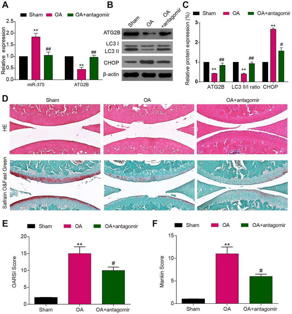 MiR-375 antagomir alleviated DMM-induced OA. (A) Down-regulated expression of miR-375 in chondrocytes after antagomir treatment and increased levels of ATG2B in DMM-injured OA knees. (B, C) Expression of ATG2B, LC3I/II, CHOP was detected by western blot. (D) Safranin O and Fast Green and HE stained sections of knee joints. (E, F) Cartilage destruction evaluated with the OARSI and Mankin scores. Scale bar: 50 μm. Data per group are expressed as mean ± SEM calculated from six mice. ** PPP