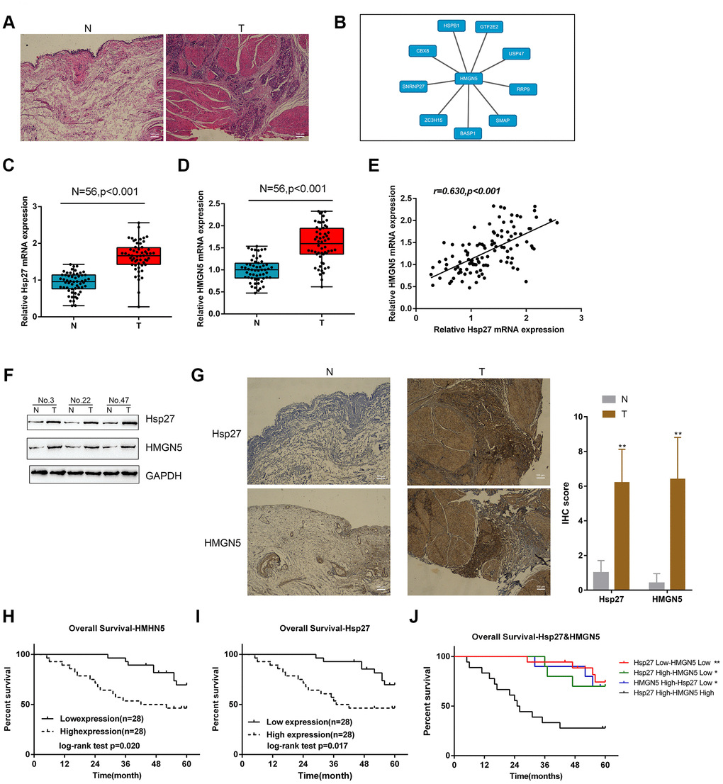 Expression and correlation of HMGN5 and Hsp27 in tissue samples. (A) Pathological characteristics of normal and bladder cancer tissues assessed by HE staining. (B) Protein-protein-interaction analysis showing proteins related to HMGN5 based on data from BioGRID (https://thebiogrid.org/). (C, D) The expression of Hsp27 and HMGN5 in 56 paired normal and bladder cancer tissues examined by qPCR. (E) The correlation of Hsp27 and HMGN5 mRNA expression in tissue samples analyzed by Pearson’s correlation analysis. (F) The protein levels of Hsp27 and HMGN5 in tissue samples were examined by immunoblotting. (G) The protein levels and localization of Hsp27 and HMGN5 in tissue samples were examined by IHC staining. (H–J) The association of Hsp27 and HMGN5 expression with overall survival was analyzed by Kaplan-Meier overall survival analysis.