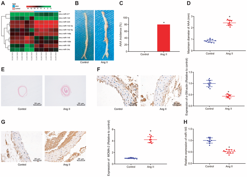 GEO bioinformatics analysis predicting poorly expressed miR-145 in mice with Ang II-induced AAA. (A) a heatmap of the top 10 differentially expressed miRNAs obtained from the AAA-related microarray data GSE51226 downloaded from the Gene Expression Omnibus (GEO) database (https://www.ncbi.nlm.nih.gov/geo/); the abscissa represents sample number and the ordinate represents names of miRNAs; each small square in the figure represents the expression level of a miRNA in one sample, and the histogram in the upper right represents color grading; (B) representative images of the morphology of abdominal aorta specimens of the control ApoE-/- mice and Ang II-induced AAA ApoE-/- mice; (C) incidence of AAA in ApoE-/- mice; (D) the maximum diameter of abdominal aorta in mice; (E) morphological changes of abdominal aorta in mice observed by HE staining (× 400); (F) α-SM-actin expression in SMCs in abdominal aorta determined using immunohistochemistry (× 400); (G) MOMA-2 expression in monocyte and SMCs in abdominal aorta determined using immunohistochemistry (× 400); (H) miR-145 expression measured using RT-qPCR; * p -/- mice; measurement data were depicted as the mean ± standard deviation; comparisons between the two groups were analyzed using an unpaired t-test; n = 10.