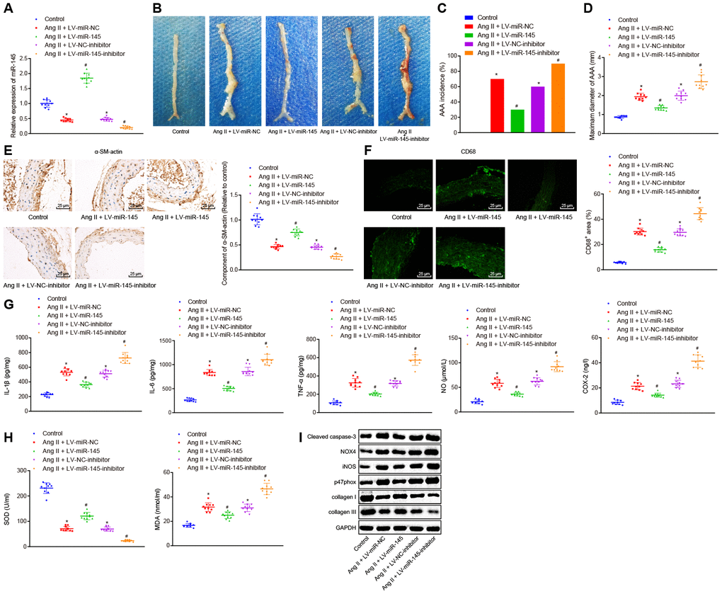 miR-145 suppresses the occurrence and progression of AAA in ApoE-/- mice. (A) interference efficiency of miR-145 verified by RT-qPCR; (B) representative morphology images of abdominal aorta specimens in mice; (C) incidence of AAA in mice; (D) the maximum diameter of abdominal aorta in mice; (E) α-SM-actin expression in SMCs in abdominal aorta determined using immunohistochemistry (× 400); (F) CD68 expression in abdominal aorta detected using immunofluorescence staining (× 400); (G) levels of COX-2, NO, IL-1β, IL-6 and TNF-α in serum of mice measured using ELISA; (H) SOD level in serum and MDA level in abdominal aorta of mice; (I) protein levels of cleaved caspase-3, NOX4, iNOS, p47phox, collagen I and collagen III determined using Western blot analysis; * p vs. normal mice; # p vs. AAA mice injected with LV-miR-NC or LV-NC-inhibitor plasmids; measurement data were depicted as the mean ± standard deviation; comparisons among multiple groups were analyzed using one-way ANOVA followed by Turkey’s post hoc test; n = 10.