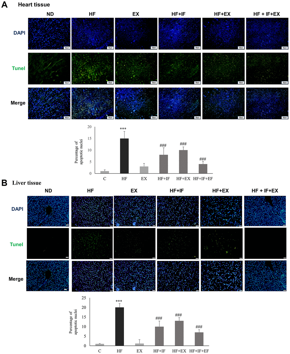 IF administration during exercise show better protection from HFD induced hepatic and cardiac apoptosis in aging accelerated SAMP8 mice. TUNEL staining show the difference in TUNEL positive cells induced by HFD feeding in heart (A) and liver (B) tissues in different groups (n=6) of SAMP8 mice. The nucleus are stained in blue and the TUNEL positive apoptotic nuclei are stained in green. C: Control; HF: High-fat diet; EX: Exercise; HF+IF: High-fat diet+IF; HF+EX: High-fat diet+ Exercise; HF+EX+IF: High-fat diet+ Exercise+ IF. Scale bars, 200 μm. (Magnification, 200x). Bars indicate the mean ± SEM obtained from experiments performed in triplicate. ***P###P