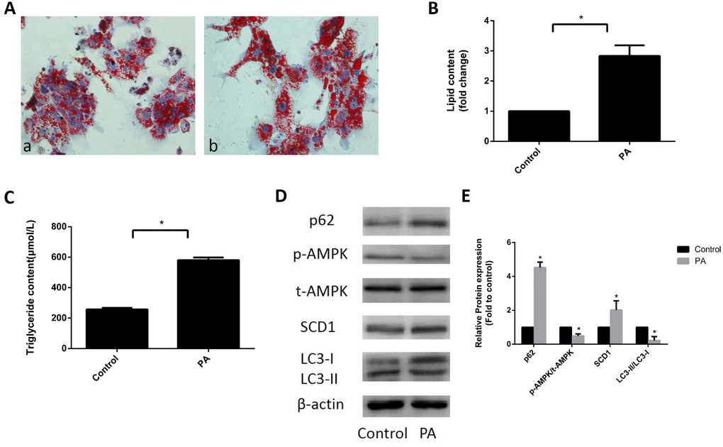 Expression of SCD1 and activation of AMPK and lipophagy in sodium palmitate-treated primary hepatocytes. (A) Primary hepatocytes were stained with Oil Red O and observed under an optical microscope. a, control group; b, PA group. (B) The intracellular lipid content in each group was quantified. (C) TG levels were measured with an enzymatic assay kit. (D, E) Protein levels were determined by Western blotting. The data are presented as the means±SDs. *p  versus control.