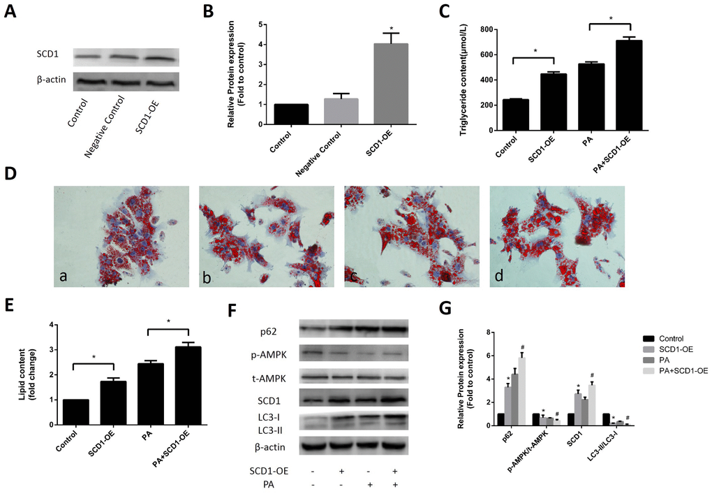 Effects of SCD1 over-expression on lipid deposition and activation of AMPK and lipophagy in primary hepatocytes. (A, B) The effect of SCD1-OE infection was verified by Western blotting. (C) TG levels were measured after infection with SCD1-OE. (D) Primary hepatocytes were stained with Oil Red O. a, control group; b, SCD1-OE group; c, PA group; d, PA+SCD1-OE group. (E) The intracellular lipid content in each group was quantified. (F, G) Protein levels were determined by Western blotting. The data are presented as the means±SDs. *p  versus control, #p  versus the PA group.