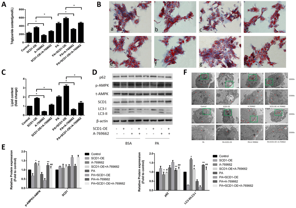 Effects of cotreatment with SCD1-OE and the AMPK activator on lipid deposition and lipophagy in primary hepatocytes. (A) TG levels were measured. (B) Primary hepatocytes were stained with Oil Red O. a, control group; b, SCD1-OE group; c, A-769662 group; d, SCD1-OE+A-769662 group; e, PA group; f, PA+SCD1-OE group; g, PA+A-769662 group; h, PA+SCD1-OE+A-769662 group. (C) The intracellular lipid content in each group was quantified. (D, E) Protein levels were determined by Western blotting. (F) Autophagosomes and autolysosomes in hepatocytes were observed by TEM. The red arrow indicates autophagosomes and autolysosomes. The data are presented as the means±SDs. *p  versus control, #p  versus the SCD1-OE group, **p  versus the PA group, ##p  versus the PA+SCD1-OE group.