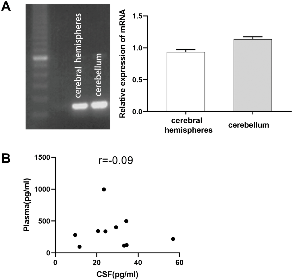 Expression of thrombopoietin (TPO) mRNA in human cerebral hemisphere and cerebellum. There was no correlation between the TPO levels in blood plasma and cerebrospinal fluid (CSF). (A) TPO mRNA expression in human cerebral hemisphere and cerebellum was detected by RT-PCR, n = 3. (B) Scatter plot of TPO levels in blood plasma and CSF, r = –0.09, P = 0.80, n = 10.