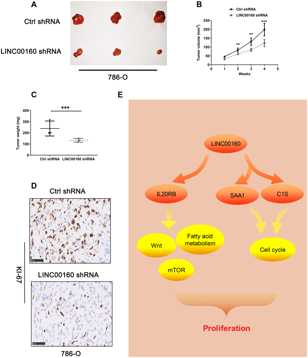 The knockdown of LINC00160 levels inhibits tumorigenesis in vivo. (A–C) Tumor size, volume curves, and weight in the xenograft formation assay, (D) The expression of Ki67 protein in xenograft tumor tissues. (E) Schematic diagram of LINC00160 in ccRCC. Data was represented as the mean±SEM. *P 