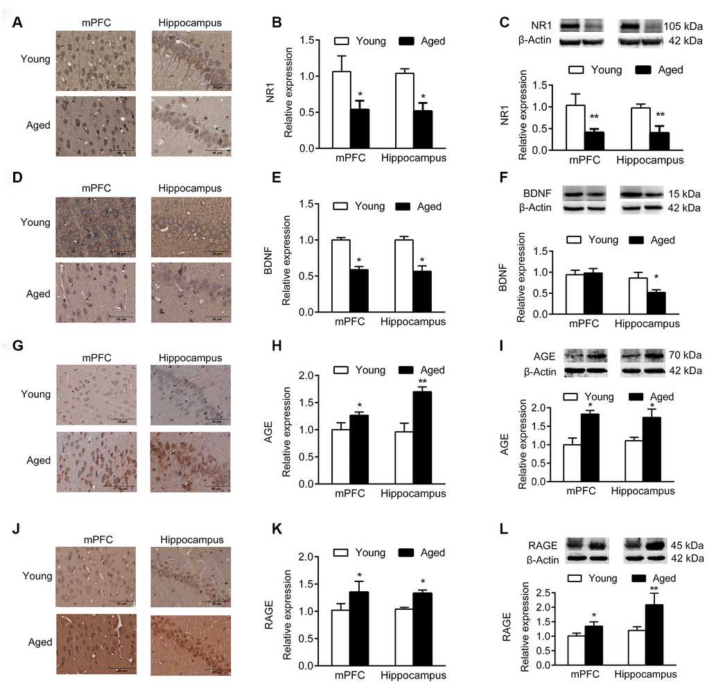 Expression of molecular markers in young and aged rats. n = 3. (A–C) Expression of NR1 in mPFC and hippocampus by IHC (A, B), and western blotting (C). (D–F) Expression of BDNF in mPFC and hippocampus by IHC (D, E), and western blotting (F). (G–I) Expression of AGE in mPFC and hippocampus by IHC (G, H), and western blotting (I). (J–L) Expression of RAGE in mPFC and hippocampus by IHC (J–K), and western blotting (L). Error bars represent the SEM. * P P 