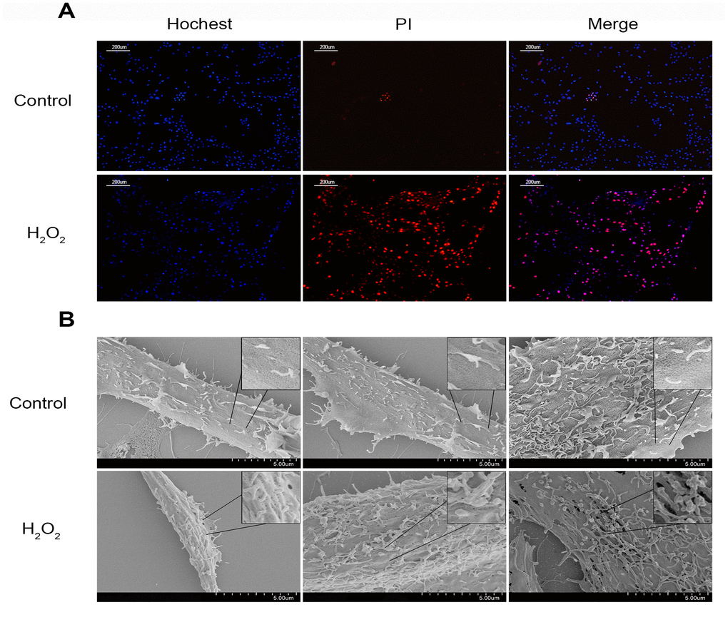 The change of the cell membrane permeability of NPCs caused by hydrogen peroxide. (A) Hochest33342/PI double staining revealed hydrogen peroxide (200μM, 3h) increased the PI positive nucleus pulposus cells (magnification: ×10, scale bar = 200μm). (B) The scanning electron microscopy showed that ball-like bulge and membrane pore-forming were increased by hydrogen peroxide.