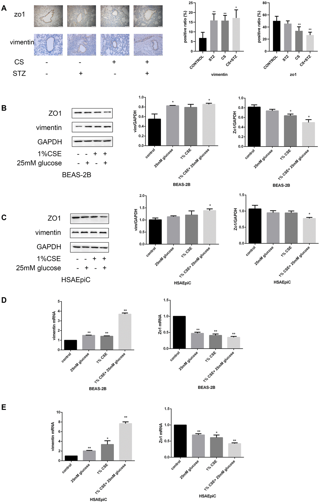 High glucose levels and CS exposure activated EMT in AECs. (A) Immunohistochemical results and positive ratios of Zo1 and vimentin in control, COPD, diabetic and COPD diabetic rats. (B–E) AECs were treated with 25 mM glucose, 1% CSE or both for 24 hours. Western blots of Zo1 and vimentin in BEAS-2B (B) and HSAEpiC (C) cells. qRT-PCR analyses of Zo1 and vimentin in BEAS-2B (D) and HSAEpiC (E) cells. * p