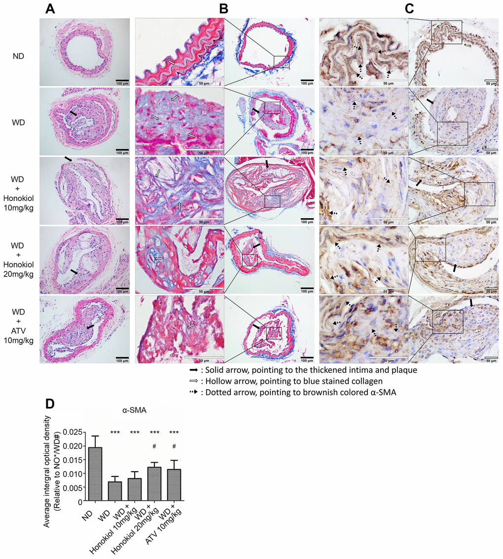 Effect of honokiol on the formation of carotid atherosclerotic plaque in ApoE-/- mice. (A) Representative HE staining images showing the formation of atherosclerotic plaque and vascular morphology changes (black solid scale bar: 100μm for 200×; black solid arrows point to the thickened intima and plaque). (B) Representative Masson trichrome staining images showing aortic collagen formation (black solid scale bar: 100μm for 200X; hollow scale bar: 50μm for 400X; black solid arrows point to the thickened intima and plaque; hollow arrows point to blue stained collagen). (C) The expression of α-SMA in carotid tissue was assessed by immunohistochemical staining (hollow scale bar: 50μm for 400X; black solid arrows point to the thickened intima and plaque; black dotted arrows point to brownish colored α-SMA). (D) The average integral optical density of α-SMA in carotid tissue was quantitatively analyzed by Gel-Pro Analyzer 4.5 software. (n = 6; *P P P P P P 