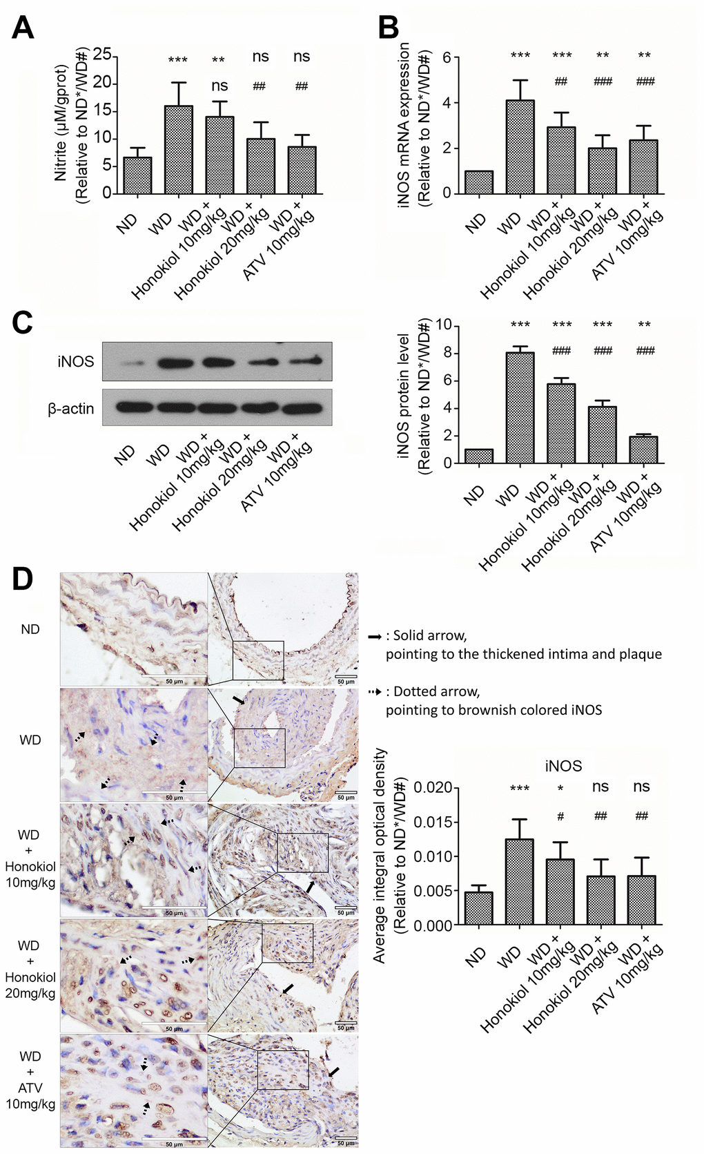 Effect of honokiol on NO production and iNOS expression in the carotid tissue of atherosclerotic mice. (A) The amount of nitric oxide in carotid tissue from the indicated experimental groups. (n = 6; * P P P P P P B) The mRNA expression of iNOS in carotid tissue obtained from the indicated groups was detected by real-time PCR. (n = 6; * P P P P P P C) Western blotting was performed to evaluate iNOS protein expression in carotid tissue obtained from the indicated groups (upper panel). β-actin was served as a loading control. Quantification of the band density is shown in the right panel. (n = 6; * P P P P P P D) Representative immunohistochemical staining images of iNOS in carotid tissue obtained from the indicated groups (hollow scale bar: 50μm for 400X; black solid arrows point to the thickened intima and plaque; black dotted arrows point to brownish colored α-SMA). The average integral optical density of iNOS in carotid tissue was quantitatively analyzed and shown in the right panel. (n = 6; * P P P P P P 