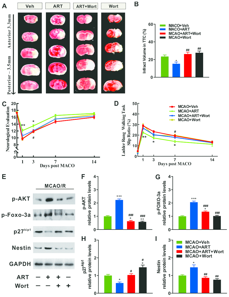 PI3K/Akt/FOXO-3a/p27Kip1 signaling is involved in ART-mediated cerebral infarct volume and neurologic impairment of MCAO animals. (A, B) The cerebral infarct volume was revealed by TTC staining at 72h after MCAO, and the cerebral infarct volume was quantified. (C) Neurological evaluation (18-point scale assessment of the impairment severity) was used to measure somatosensory movement function. (D) The ladder rung walking task was performed to evaluate fine motor function, and the slip ratio of contralateral limbs was counted within 50 steps. (E–I) Representative western blotting for PI3K/Akt/FOXO-3a signaling related molecules (p-AKT, p-FOXO-3a, p27kip1) and Nestin. Data are shown as the mean ± SEM. (*p