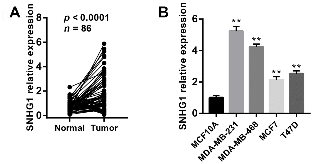 SNHG1 expression is up-regulated in breast cancer tissues and cell lines. (A) Q-RT-PCR analysis of SNHG1 mRNA levels in collected breast cancer tissues (Tumor) and adjacent normal tissues (Normal). n=86, pB) Q-RT-PCR analysis of SNHG1 mRNA levels in MCF10A mammary epithelial cell lines and four different breast cancer cell lines. **p