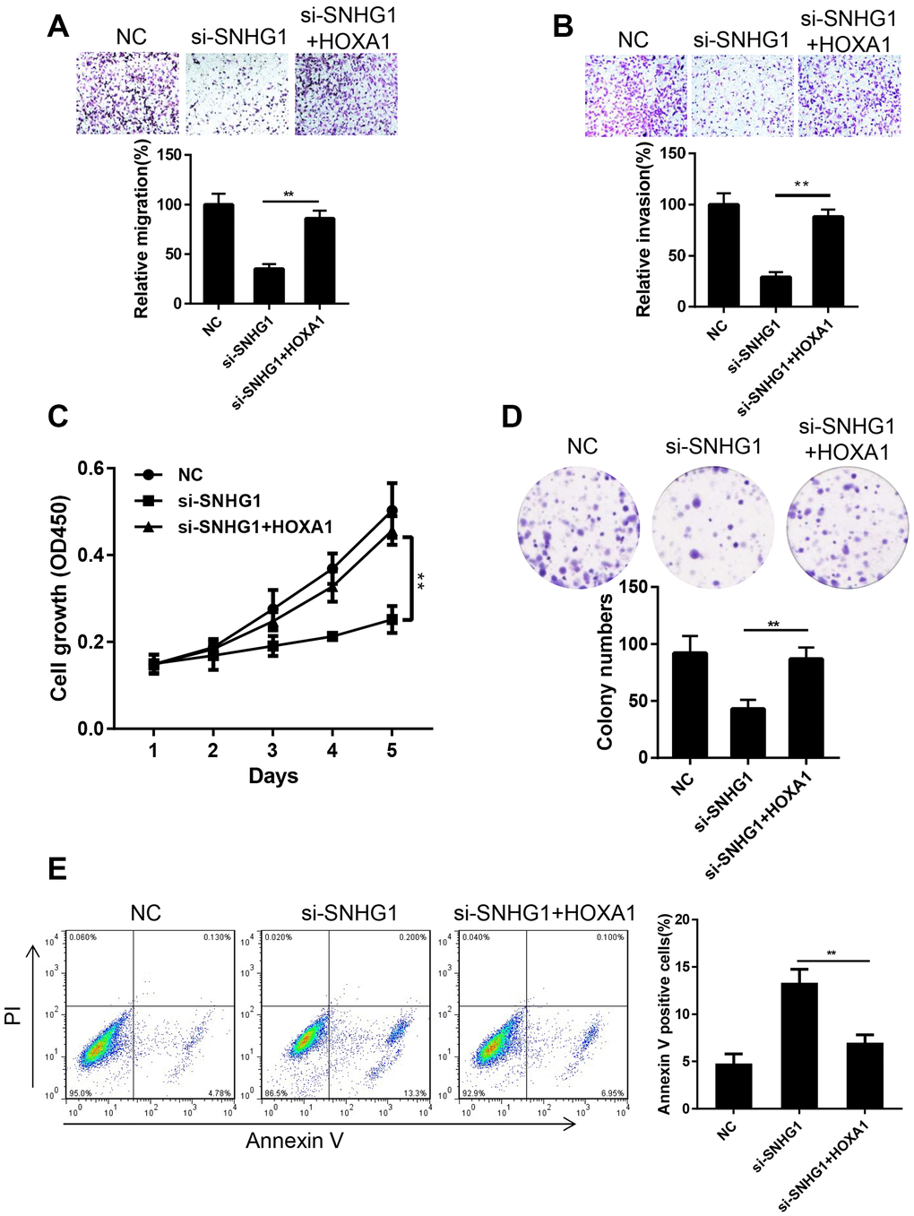Ectopic expression of HOXA1 reversed the effect of SNHG1 silencing on MDA-MB-231 cells. (A, B) Migration (A) and invasion (B) of MDA-MB-231 cells transfected with NC, si-SNHG1 and si-SNHG1+HOXA1 were examined by transwell assay. Representative images of the cells migrated or invaded to the lower chamber side (top panel). Cell migration and invasion capacities were shown as a percentage of NC control (bottom panel). **pC, D) Proliferation of MDA-MB-231 cells transfected with NC, si-SNHG1 and si-SNHG1+HOXA1 was examined by CCK-8 assay (C) and colony formation assay (D). (E) Apoptosis of MDA-MB-231 cells transfected with NC, si-SNHG1 and si-SNHG1+HOXA1 was measured using flow cytometry. **p