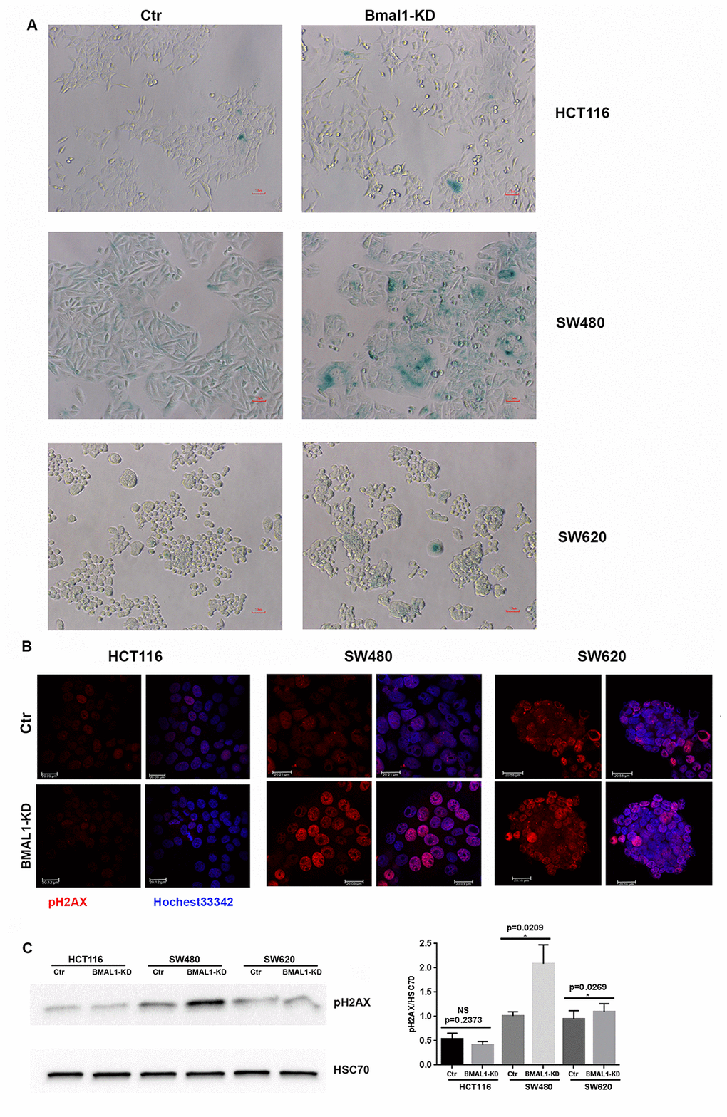 BMAL1-KD increased senescence in SW480 BMAL1-KD but not in HCT116 BMAL1-KD and SW620 BMAL1-KD cells. (A) Senescence-associated β-galactosidase (SA-β-gal) activity was obviously increased in SW480 BMAL1-KD cells, but not in HCT116 BMAL1-KD nor in SW620 BMAL1-KD cells. SA-β-gal activity was measured by β-galactosidase staining (blue). Scale Bar represents 10 μM. Representative staining of three independent experiments was shown. (B) Immunofluorescence identified phosphorylated H2AX (pH2AX, red) in cell nuclei (Hoechst 33342, blue) of BMAL1-KD and control CRC cell lines. Representative staining of three independent experiments were shown. Scale bar, 20 μm. (C) Western-blot revealed significant increase of pH2AX mainly in SW480 BMAL1-KD cells. Left, a representative immunoblot of three independent experiments was shown. Right, Bar charts represented pH2AX expression level normalized to HSC70 (n=7; *p