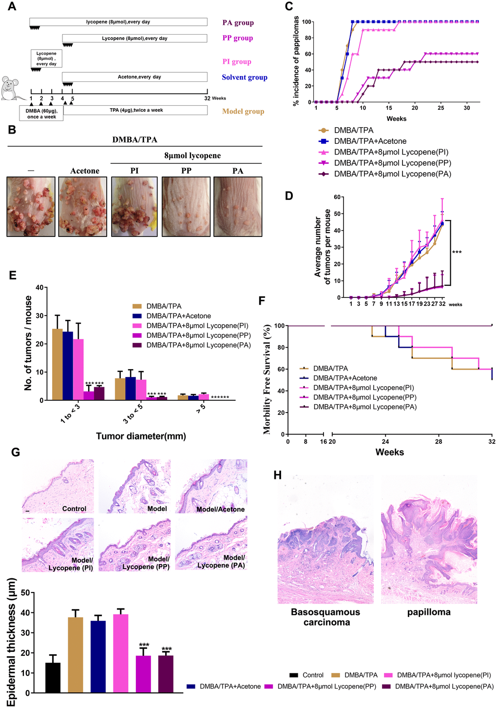 Chemopreventive effect of lycopene on DMBA/TPA-induced cutaneous papilloma in vivo. (A) The workflow of animals study as described in results and methods. (B) Representative images of papillomas in the indicated groups. (C) The incidence of papillomas in different treatment groups (n=10). (D) The average numbers of papillomas per mouse in the indicated groups (n=10). The data are presented as the mean ± SD. ***p E) The average numbers of papillomas per mouse in different tumor diameter groups (n=10). The data are presented as the mean ± SD. ***p F) Survival rates of mice in different treatment groups within 32 weeks. (G) Presentative images of epidermal proliferation and hyperplasia in the indicated groups (40×). (Bottom) Quantitative analysis of epidermal thickness based on H&E images (n=6). The data are presented as the mean ± SD. ***p H) (Left panel) Basosquamous carcinoma was observed in mouse in DMBA/TPA model group, and local invasion of basosquamous carcinoma cells can be detected into stroma (40×). (Right panel) Only the benign papillomas can be found in PA and PP mouse with intact basement membranes and hyperplasia of the overlying epidermis (40×).