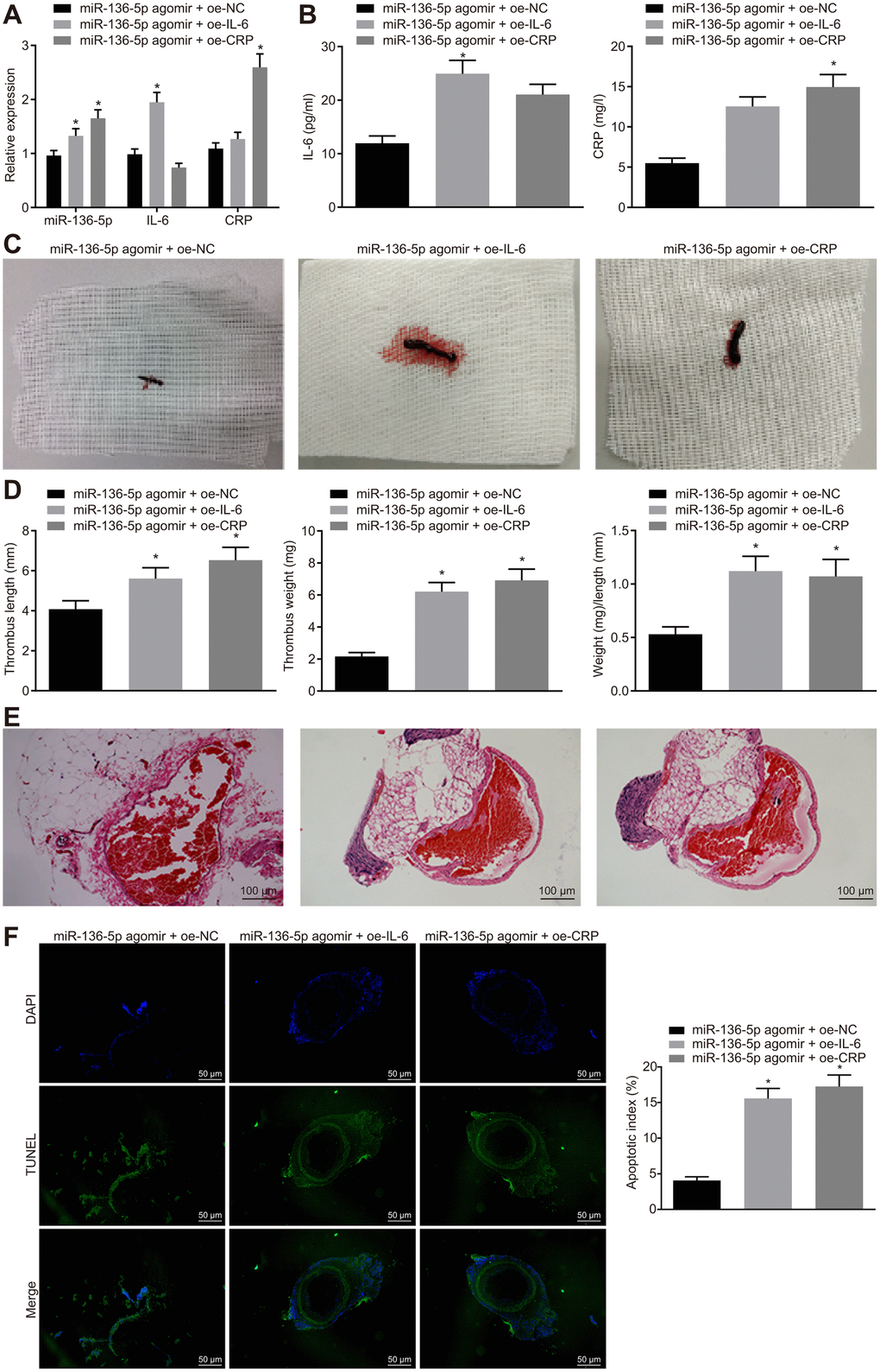 The protective role of miR-136-5p elevation against acute LEDVT is reversed by IL-6 and CRP. The rats used for following assessments were rats treated with miR-136-5p agomir + oe-IL-6, oe-CRP, or oe-NC. (A) The expression levels of miR-136-5p, IL-6, and CRP in vein tissues of rats determined by RT-qPCR. (B) The protein expression of IL-6 and CRP in peripheral blood serum of rats determined by ELISA. (C) The images of acute LEDVT in rats. (D) The length, weight, and the ratio of weight to length of the venous thrombus in response to miR-136-5p agomir + oe-IL-6, oe-CRP, or oe-NC. (E) Pathological changes in vein tissues in rats assessed by HE staining (100 ×). (F) The apoptosis of endothelial cells in the femoral vein in rats assessed by TUNEL assay (200 ×). * p 