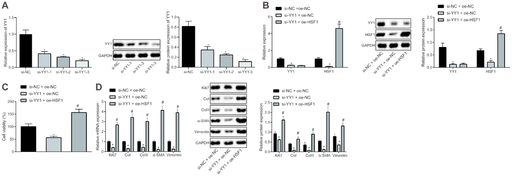 HSF1 knockdown may suppress the proliferation and fibrogenic transformation of HEPFs. (A) The YY1 expression in HEPFs transfected with three si-YY1 sequences determined at mRNA and protein levels by RT-qPCR and western blot analysis, respectively. *, p vs. cells transfected with si-NC. (B) The expression of YY1 and HSF1 in the HEPFs co-transfected with si-YY1/si-NC and oe-HSF1/oe-NC measured at mRNA and protein levels by RT-qPCR and western blot analysis, respectively. *, p vs. cells treated with si-NC and oe-NC. (C) The viability of HEPFs co-transfected with si-YY1/si-NC and oe-HSF1/oe-NC assessed by CCK8 experiment. *, p vs. cells after treatment of si-NC and oe-NC, #, p vs. cells transfected with si-YY1 and oe-NC. (D) The expression of cell proliferation marker Ki67 and fibrosis biomarkers CoI, CoIII, α-SMA and vimentin in the HEPFs co-transfected with si-YY1/si-NC and oe-HSF1/oe-NC measured at mRNA and protein levels by RT-qPCR and western blot analysis, respectively. *, p vs. cells co-transfected with si-NC and oe-NC, #, p vs. cells co-transfected with si-YY1 and oe-NC. Statistical data were measurement data, and presented as mean ± standard deviation. Unpaired t-test was used for comparison between the two groups, and one-way ANOVA with Tukey's post hoc test was employed for comparisons among multiple groups. The experiment was independently repeated three times.