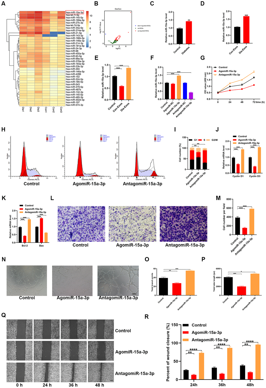 Dia-Exos were enriched with miR-15a-3p, which altered HUVEC function. (A, B) An miRNA microarray dataset of non-diabetic foot wound patients and DFU patients retrieved from NCBI GEO (accession number: GSE80178) indicated that miR-15a-3p was upregulated in foot skin from diabetic patients. (C, D) MiR-15a-3p overexpression was found in serum and exosomes from the diabetic group; n = 10 per group. (E) Effects of the two kinds of exosomes on miR-15a-3p levels in the skin tissues of mice treated with Dia-Exos. (F) qRT-PCR indicated that antagomiR-15a-3p could partially counteract the overexpression of miR-15a-3p in HUVECs. (G) A CCK-8 assay was used to assess the effects of antagomiR-15a-3p on HUVEC proliferation. (H, I) Flow cytometry was used to quantify the cell cycle distribution. (J) qRT-PCR analysis indicated that antagomiR-15a-3p could restore the mRNA levels of Cyclin D1 and Cyclin D3. (K) The effects of antagomiR-15a-3p on the apoptosis-related genes Bcl-2 and Bax were measured using qRT-PCR. (L, M) A Transwell migration assay was used to measure the effects of miR-15a-3p on HUVEC migration; scale bar: 100 μm. (N–P) A tube formation assay was used to assess the effects of miR-15a-3p on HUVEC angiogenesis; scale bar: 200 μm. (Q, R) The scratch assay results of the three groups; scale bar: 250 μm. Data are the means ± SDs of three independent experiments. *p 