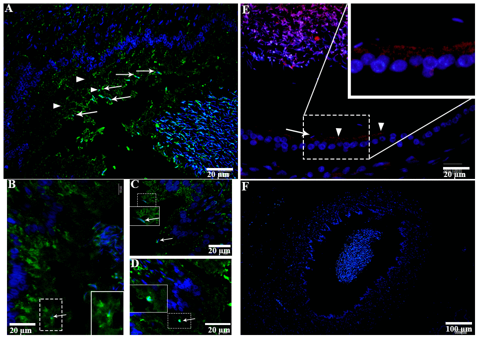 LAMP1 localization in the epididymis of turtle. LAMP1 immunolabeling (white arrowhead) in the epididymis during hibernation (A–D) and non-hibernation (E) PBS served as negative control. (F) White arrow indicates interaction of luminal spermatozoa with epithelia of epididymis. Rectangular area showed enlarged area. Scale bar: (A, B, E) 20 μm and (C, D) 10 μm.