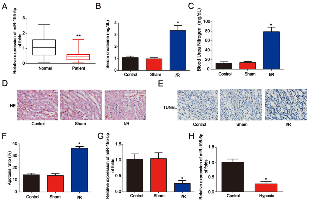Identification of miR-195-5p in AKI. (A) Analysis of miR-195-5p in serum from healthy controls and patients with AKI. U6 served as a reference control. (B) Serum Cr levels in I/R rat models. (C) BUN levels in I/R rat models. (D) Representative micrographs of renal histologic findings. Scale bars = 20 μm. (E and F) Analysis of apoptosis using the TUNEL assay in renal tissues from AKI rats. (G) miR-195-5p expression in I/R rat models. (H) miR-195-5p expression in NRK-52E cells. Cells were exposed to hypoxia for 6 h. Eight rats were used in each group. Three independent experiments were performed. Error bars represent the mean ± SD of at least three independent experiments. *P 