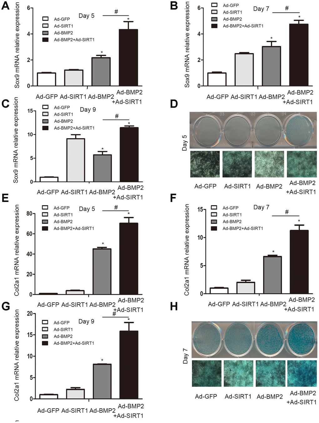 The C3H10T1/2 cells were cultured in 6-well plates after being infected with Ad-GFP, Ad-SIRT1, Ad-BMP2, or Ad-BMP2+Ad-SIRT1. (A–C) The Sox9 mRNA levels of C3H10T1/2 cells were measured after 5, 7 and 9 days using real-time PCR. (E–G) The Col2a1 mRNA levels of C3H10T1/2 cells were measured after 5, 7 and 9 days using real-time PCR. (D, H) Alcian blue staining was used to observe the secretion of extracellular matrix after the 5 and 7 days of Ad-GFP, Ad-SIRT1, Ad-BMP2, and Ad-BMP2+Ad-SIRT1 infection. The dyed 12-well plates were photographed by a camera attached to a light microscope (100X). All of the relative mRNA expression level results were compared to those of GAPDH using Quantity one. The data are denoted as the mean ± SD.*:p 