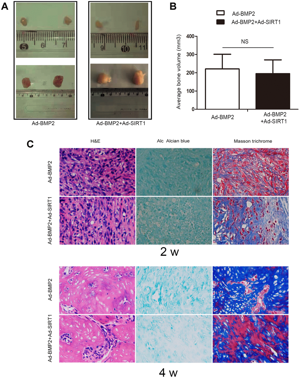 SIRT1 potentiated BMP2-induced chondrogenesis in vivo. (A) Macrographic images of the ectopic bone mass. The ectopic osseous masses were retrieved after 2 and 4 weeks. (B) The bone mass volumes were evaluated. (C) The bone masses retrieved from the Ad-BMP2 and Ad-BMP2+Ad-SIRT1 group were fixed and decalcified, and hematoxylin and eosin, Alcian blue, and Masson trichrome staining was performed on the extracted bony mass (200X). NS: p > 0.05.