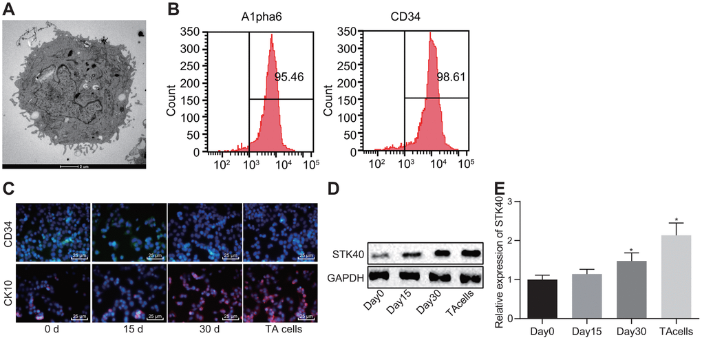 STK40 is highly expressed during HFSC differentiation into TA cells. (A) The growth of HFSCs observed under a microscope (5000 ×). (B) The expression of Alpha6 and CD34 determined by flow cytometry to sort HFSCs. (C) HFSC differentiation markers queried using immunofluorescence assay (400 ×). (D) Protein expression of STK40 normalized to GAPDH during HFSC differentiation determined using Western blot analysis. (E) Relative expression of STK40 during HFSC differentiation determined using RT-qPCR. * p vs. day 0; Measurement data were expressed as mean ± standard deviation. One-way ANOVA was utilized to compare data among multiple groups, followed by Tukey’s post hoc test. Cell experiments were conducted in triplicates.