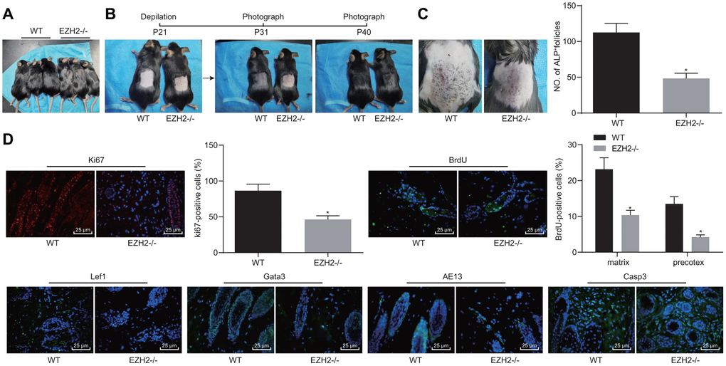 EZH2 knockout inhibits HF keratinocyte differentiation and hair growth, but facilitated apoptosis in vivo. (A) Hair loss exhibited by EZH2-/- mice of 30 days old. (B) Delayed hair growth ability in EZH2-/- mice. (C) HF in EZH2-/- mice and WT mice determined by ALP staining. (D) Expression of proliferation, differentiation, and apoptosis markers EZH2-/- mice and WT mice detected by immunofluorescence assay (400 ×). * p vs. WT mice; Measurement data were expressed as mean ± standard deviation. Unpaired t test was adopted to analyze the differences between two experimental groups if the data conformed to normal distribution and homogeneity of variance. n = 15.