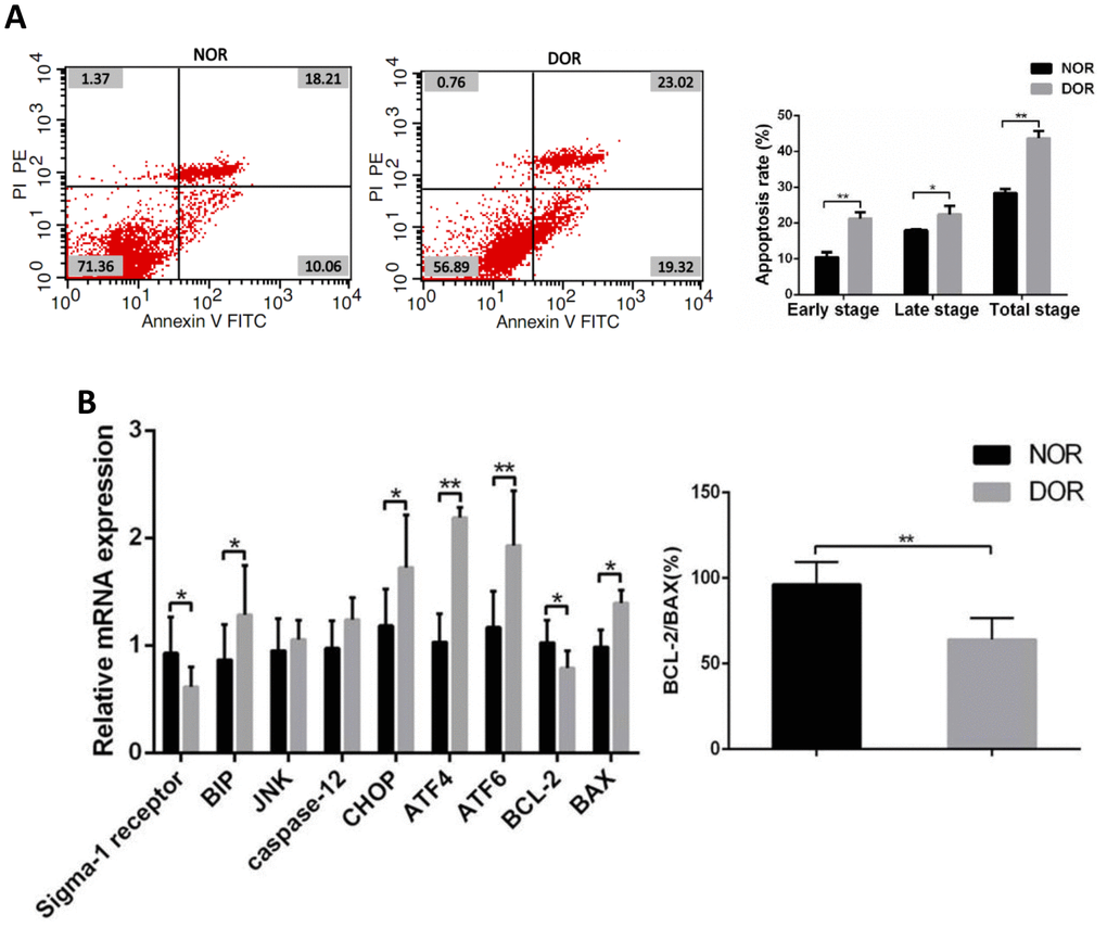 Apoptotic rate and ERS, mRNA levels of apoptosis-related genes in GCs from patients with DOR. (A) Apoptosis index in patient GCs. (B) The mRNA expression of ERS and apoptosis-related genes was increased in patient GCs. *P