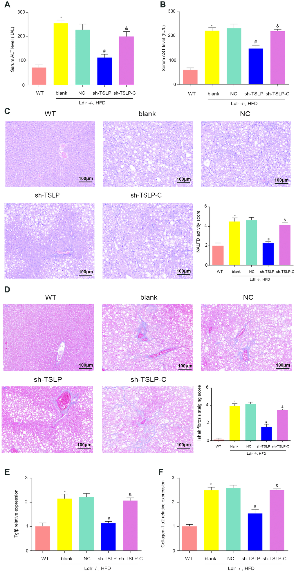 Knockdown TSLP reduced liver injury, liver fatty degeneration and liver fibrosis, which could be rescued by JAK-STAT signaling pathway activator. (A) The level of alanine aminotransferase (ALT) secreted into serum. (B) The level of aspartate aminotransferase (AST) secreted into serum. (C) Liver fatty degeneration was detected by H&E staining; (D) The degree of fibrosis was shown by Masson’s trichrome Original magnification ×200. (E) The mRNA expression level of Tgfβ and (F) The mRNA expression level of Collagen-1α2. *P #P &P 