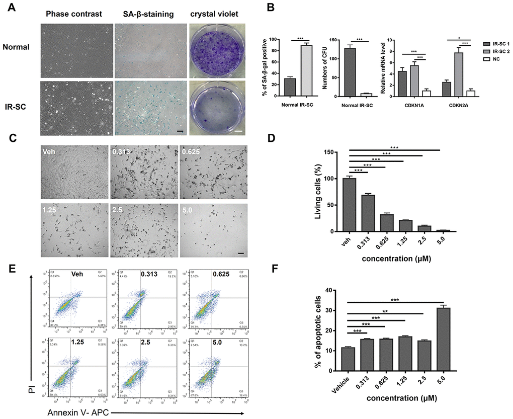 Induction of senescent rat chondrocytes by ionization irradiation and dose-dependent killing effect of ABT263 on IR-SC via apoptosis. (A) Morphology and crystal violet staining of senescent rat chondrocytes and normal rat chondrocytes. (B) Quantitative analysis of SA–β–gal staining and crystal violet staining. IR-SC 1 and IR-SC 2 were independently cultured IR-SCs generated from different batches of ionization irradiation under same circumstance. Data were presented as mean ± standard deviation. N = 3 per group. of fold changes from 3 independent experiments. **P C) Representative images of IR-SC in culture after incubation with increasing concentrations of ABT263 for 72 h. Scale bar: 100 μm. (D) statistical analysis of living cells of three independent experiments is shown. (E) Analysis of cell apoptosis by flow cytometry with increasing concentrations of ABT263 after 48h treatment. (F) Statistical results of apoptotic cells of three replicates are also shown.