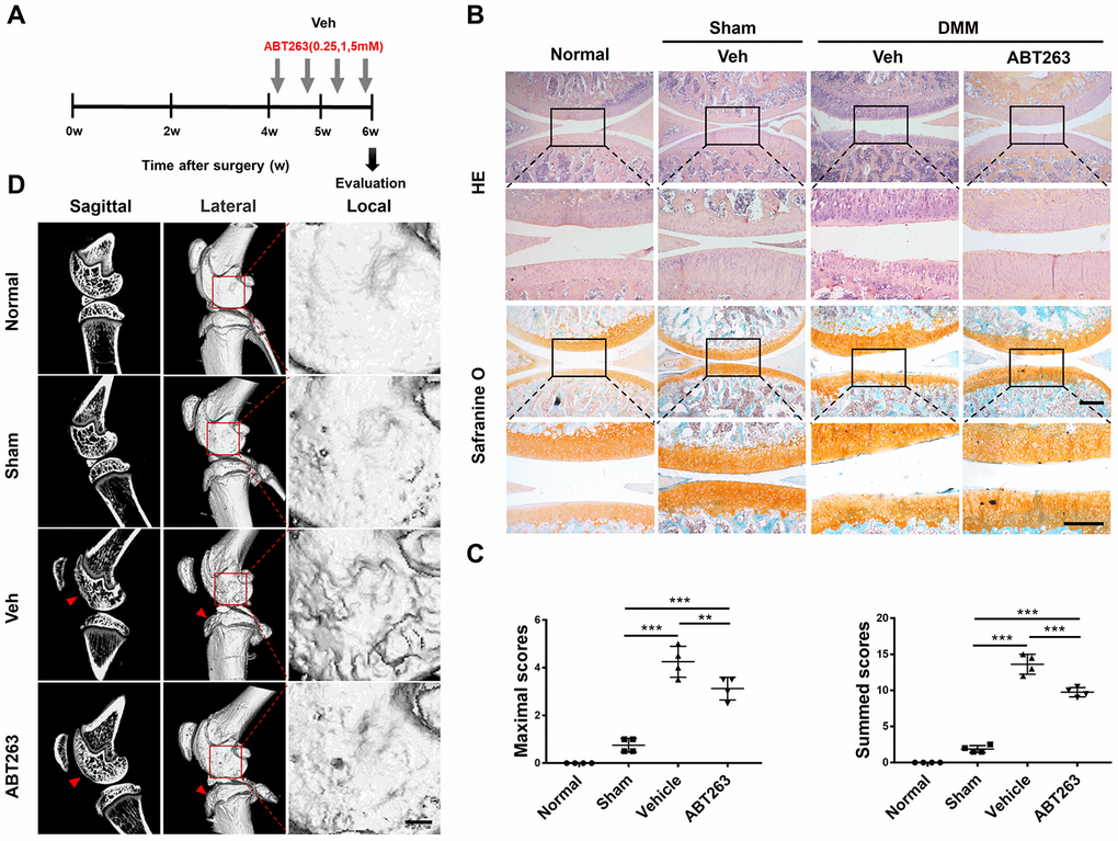 Senescent cells clearance by treatment with ABT263 after rat DMM surgery attenuates the injury of post-traumatic OA. (A) Schematic of the time course for the experiments in b–d. Male SD rat that underwent DMM surgery were injected intra-articularly every other day with vehicle (Veh) or ABT263 for two weeks and evaluated as indicated. (B) Representative images of Hematoxylin and eosin staining and safranin O and methyl green staining of the medial femoral condyle and medial tibial plateau in rat right knee. Scale bar: top: 500 μm; bottom: 100μm. (C) OARSI scores of the knee joints of rat with DMM or sham surgery. N = 4 per group. (D) Sagittal micro-CT and three-dimensional reconstruction images of the hind knee joint from different groups. ABT263 of 1.0 mM was corresponded to the results presented in B, C and D; Data are shown as mean ± standard deviation. Scale bar: 2 mm.