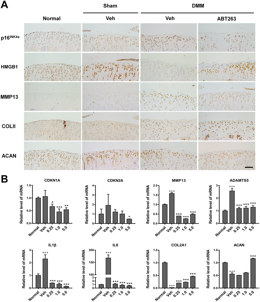 Elimination of SnCs by ABT263 and alleviation inflammatory microenvironment in vivo. (A) immunohistochemical analysis for expression of p16INK4a, HMGB1, COLII and ACAN of rat cartilage after 2 weeks intra-articular injection of ABT263. Result from ABT263 of 1.0 mM was presented. Scale bar: 100 μm. (B) mRNA level analysis using real-time qPCR for CDKN1A, CDKN2A, MMP13, ADAMTS5, IL1β, IL6, COLII and ACAN in the rat knee joint. Data are shown as mean ± standard deviation. N = 3 per group. +p