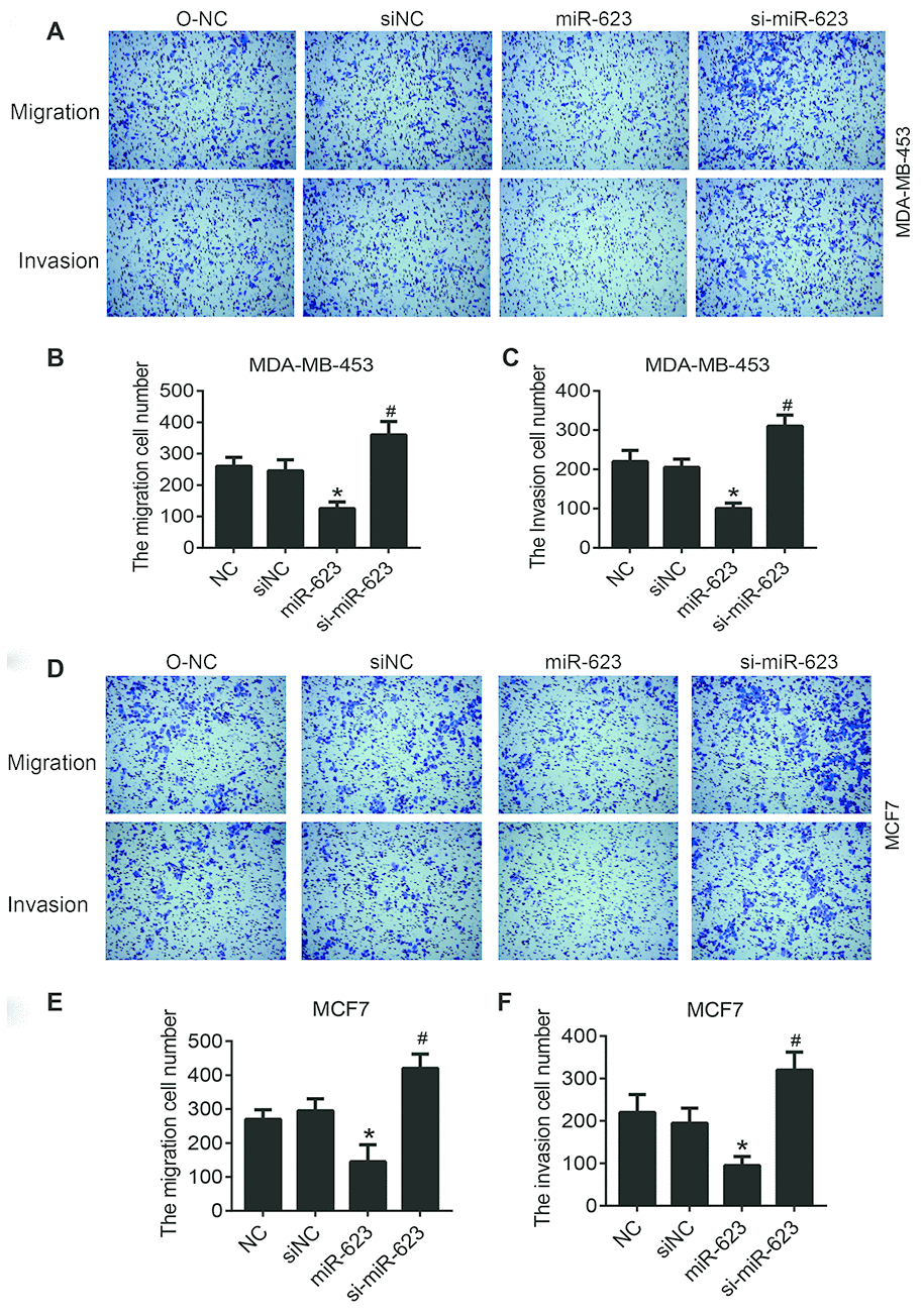 Effects of miR-623 on cell migration and invasion. The migration and invasion of MDA-MB-453 cells (A–C) and MCF7 cells (D–F) were analyzed by transwell migration assays and matrigel invasion assays, respectively. 10% FBS was used as the chemoattractant. Results are represented from three independent experiments. P values were determined using Student’s t-tests. *PP