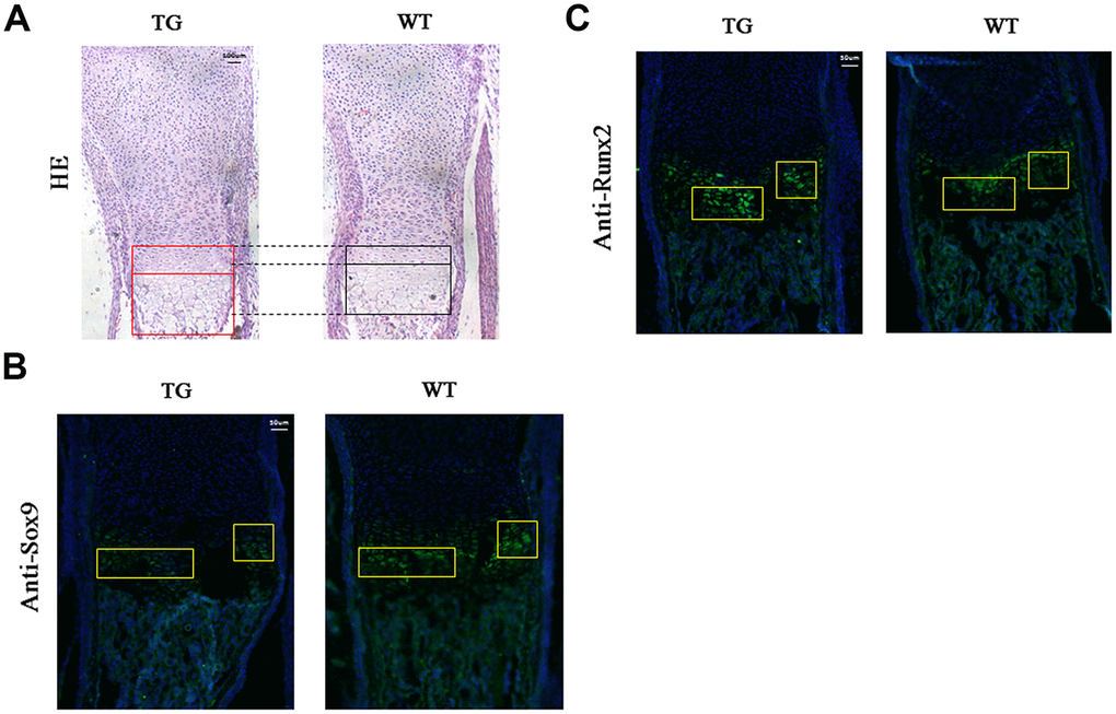 Histological and immunofluorescent analysis of Col10a1-TAp63γ transgenic mice. (A) The proliferative and hypertrophic zones of the limb cartilage in Col10a1-TAp63γ transgenic and WT mice were evaluated by hematoxylin and eosin (H&E) staining. Scale bar, 100 μm. (B) Sagittal sections of the distal humerus from both WT and transgenic mouse limbs at postnatal day 1 were subjected to immunofluorescent analysis using an anti-Sox9 antibody. Scale bar, 50 μm. (C) Sagittal sections of the distal humerus from both WT and transgenic mouse limbs at postnatal day 1 were subjected to immunofluorescent analysis using an anti-Runx2 antibody (label as Sox9 and some description of the findings). Scale bar, 50 μm.