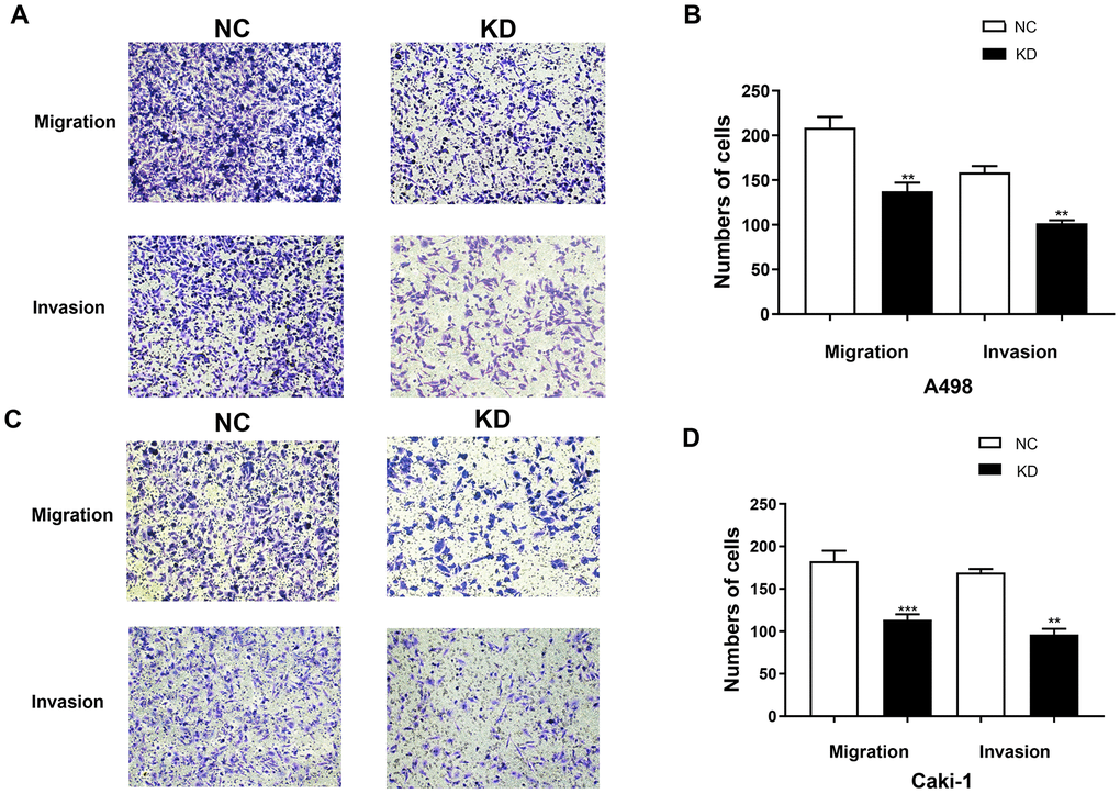 TIMP1 knockdown inhibited the migration and invasion of A498 and Caki-1 cells. (A) Migration and Matrigel invasion assays of A498 cells transfected with TIMP1 shRNA or NC were evaluated. (C) Migration and Matrigel invasion assays of Caki-1 cells transfected with TIMP1 shRNA or NC were evaluated. (B, D) Migrated and invaded cells were counted in 3 random 100× fields (* p