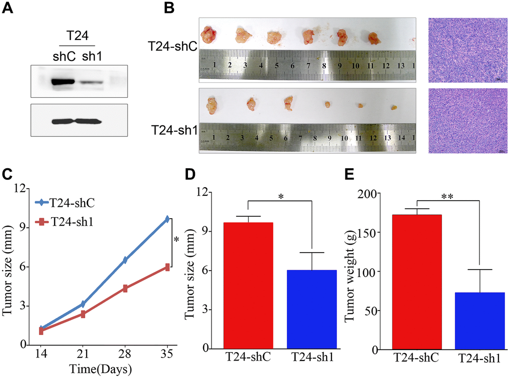 PRMT5 had a strong oncogenic function in bladder cancer. (A) Western blotting showed that PRMT5 was efficiently knocked down by PRMT5-shRNA. (B) Representative images of the tumor xenografts inoculated with T24-shC and T24-sh1 cells and hematoxylin and eosin staining of tumor xenografts are shown. (C–E) Growth curve and histogram analysis of the size and weight of xenograft tumors. Error bars show the standard error of the mean. sh, short hairpin RNA; T24-shC: T24-shRNA/negative control; T24-sh1: T24-shRNA. *P P 