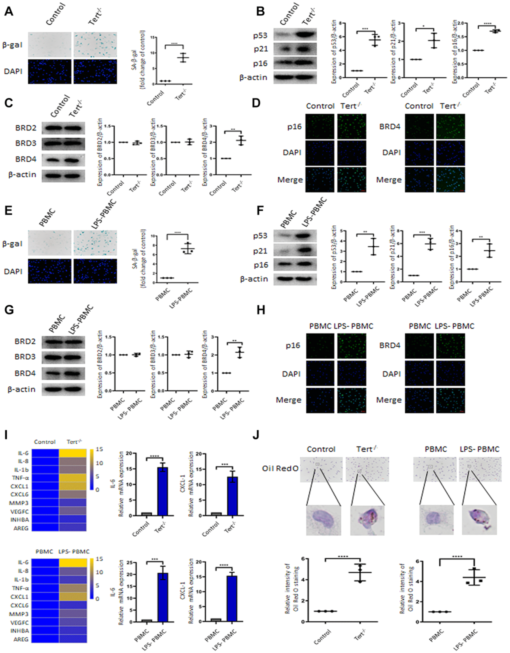 BRD4 promotes the senescence of mouse peritoneal macrophages and human peripheral blood mononuclear cells. The primary peritoneal macrophages isolated from Tert-/- senescent mice and human peripheral blood mononuclear cells (PBMCs) were prepared. (A, E) SA-β-gal staining images and the corresponding quantification in peritoneal macrophages of Tert-/- mice and PBMCs. Scale bar, 50 μm. (B, F) Western blotting and statistical analysis of protein expression of aging-related markers p53, p21, and p16. (C, G) Western blot analysis of BRD2, BRD3, and BRD4 in two different cells. (D, H) Confocal microscopy was used to verify the expression of p16 and BRD4 in peritoneal macrophages of Tert-/- mice and PBMCs. Scale bar, 50 μm. (I) qRT-PCR analysis of mRNA expression of SASP in peritoneal macrophages of Tert-/- mice and PBMCs and representative differentially expressed IL-6 and CXCL1. (J) Oil Red O staining measured lipid accumulation in peritoneal macrophages and PBMCs. The number of positive results was counted. Scale bar, 50 μm. The data all represent measurement data presented as the mean ± SD. The two groups were statistically analyzed using independent sample t-test. The experiment was repeated three times. Significant differences among the different groups are indicated as *p p p p p p p 