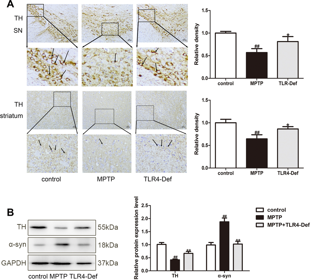 TLR4 plays a vital role in MPTP-induced pyroptosis. (A) TLR4-Def group inhibited MPTP-induced the reduction of TH-positive neurons in SN and striatum by immunochemical staining (n = 3). Original magnification: x200. (B) Western blotting was performed to determine the expressions of TH and α-syn in SN and striatum of TLR4-Def PD mice (n = 3). All data are represented as mean ± SD. # P ## P 