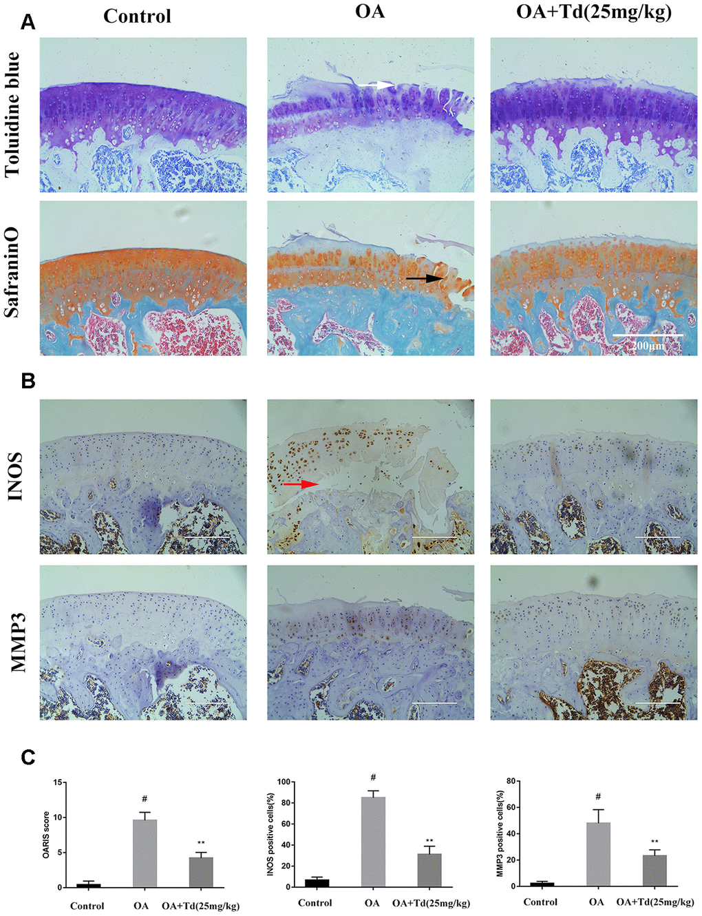 Tomatidine ameliorates OA progression in the rat OA model. Sprague Dawley rats (n=5/group) were randomly divided into blank control, OA, and experimental groups. The experimental group rats were fed a diet that included 25mg/kg/day tomatidine. The rats were maintained in these groups for 12 weeks and then euthanized and their tibiofemoral joints were obtained and processed (A) Representative images show safranin O-fast green(S-O) and toluidine blue stained sections of tibiofemoral joints from blank control, OA and experimental group rats. The vertical fissures (black arrow), surface discontinuity (white arrow) and delamination (red arrow) are indicated in the relevant samples as shown. (B) Representative immunohistochemical stained images show the expression of iNOS and MMP3 proteins in tibiofemoral joint sections from blank control, OA and experimental group rats. (C) The OA grades of blank control, OA and experimental group rats at 12 weeks according to the Osteoarthritis Research Society International (OARSI) scores are shown. The scoring was performed in a blinded manner. The iNOS and MMP3 positive cells were counted in each tibiofemoral joint section from blank control, OA and experimental group rats and quantified using the Image-J software. #p 