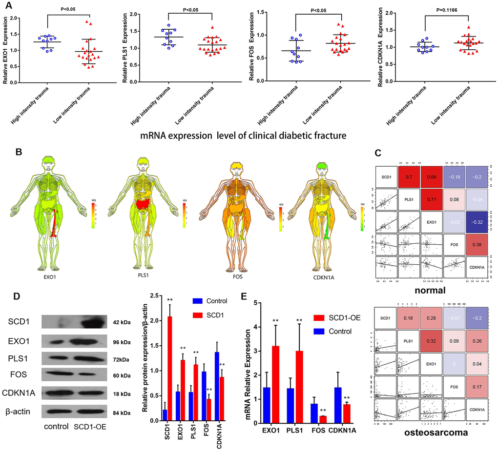 CDKN1A, FOS, EXO1 and PLS1 are regulated by SCD1. (A) Independent t-test results for the association between mRNAs (EXO1, PLS1, FOS and CDKN1A) and trauma energy in patients with clinical diabetic fractures patients. (B) Human tissue-enriched protein expression map of EXO1, PLS1, CDKN1A and FOS. (C) In the bone marrow, PLS1 and EXO1 are highly expressed, whereas CDKN1A and FOS are relatively low. (D) A represent Western blot showing overexpression of SCD1 in BM-MSCs transduced with lentivirus (“SCD1-OE”). “Control” cells are intact BM-MSCs before transduced with lentivirus. (E) Relative expression of mRNAs (EXO1, PLS1 FOS and CDKN1A) showing overexpression of SCD1 in BM-MSCs transduced with lentivirus (“SCD1-OE”); “Control” cells are intact BM-MSCs before transduced with lentivirus.